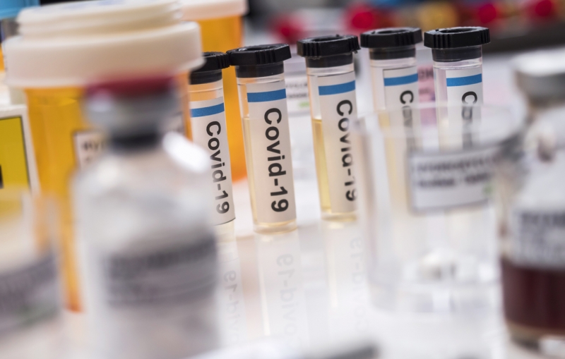 RIZAPグループが新型コロナウイルス拡大防止のため、全ての従業員と利用者に抗体検査を無償で実施