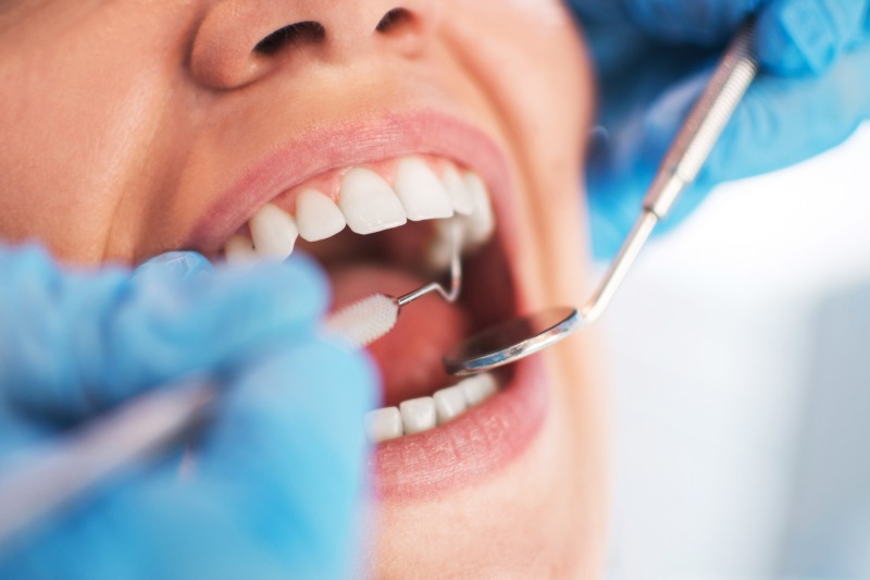 新型コロナ感染拡大で「歯科受診を控えたい」が約6割に…歯と口内の健康リスク増大が浮き彫り